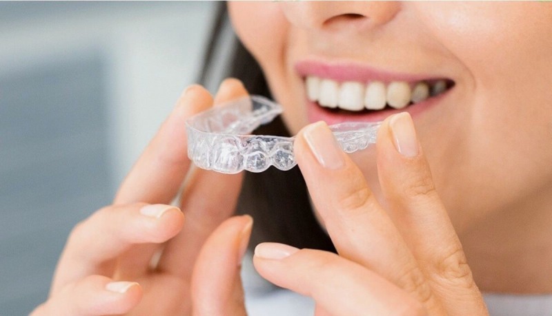 Clear Aligner